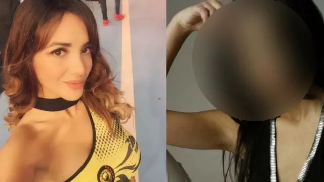 Rosángela Espinoza revelas fotos de su pasado tras controversia por cirugías