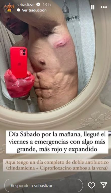¿Qué le pasó a Sebastián Lizarzaburu? / Instagram