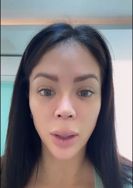 Sheyla Rojas: Así quedó su nariz tras cirugía reconstructiva