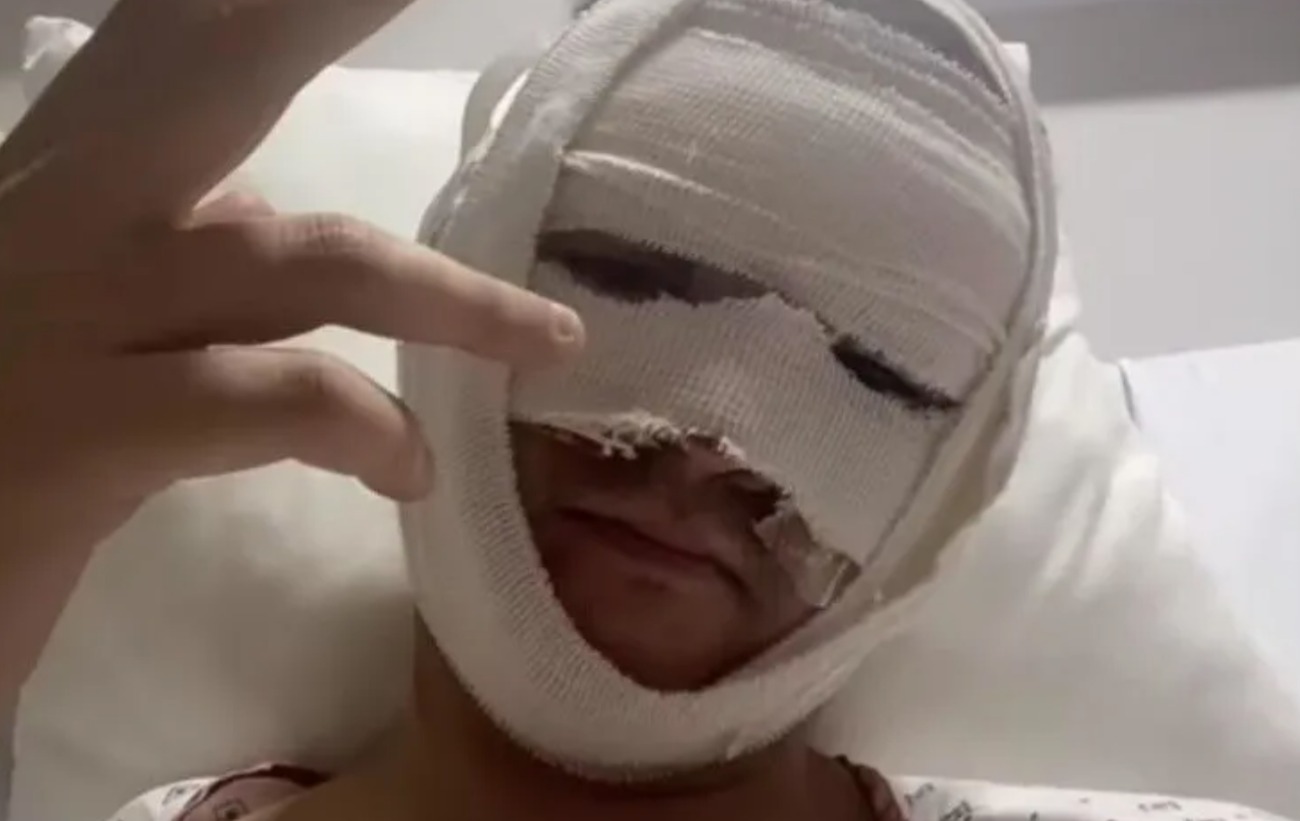 Televisa: Actor juvenil sufrió fuertes quemaduras en el rostro por una explosión 