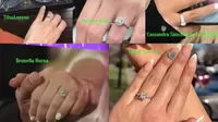 Los costosos anillos de compromiso que recibieron Tilsa Lozano, Melissa Klug  y Brunella Horna