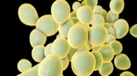 Brasil detecta su primer posible caso de infección por el hongo superresistente candida auris