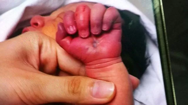 Madre conmociona China tras intentar comerse el brazo de su bebé 