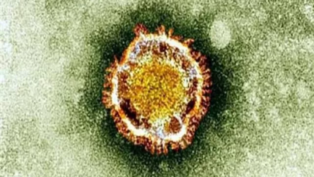 Coronavirus: Estudio identifica cinco genes asociados a formas graves de COVID-19. Foto: AFP