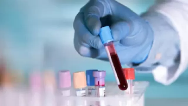 Coronavirus: Técnica de análisis de sangre revela cuando una persona ha estado expuesta al COVID-19. Foto: Shutterstock