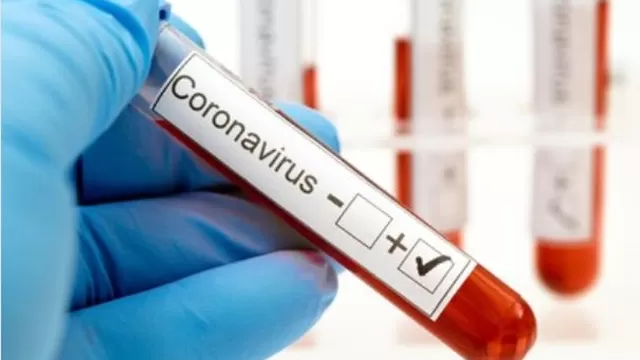 Coronavirus: Turquía registra un primer caso de la epidemia. Foto: Shutterstock