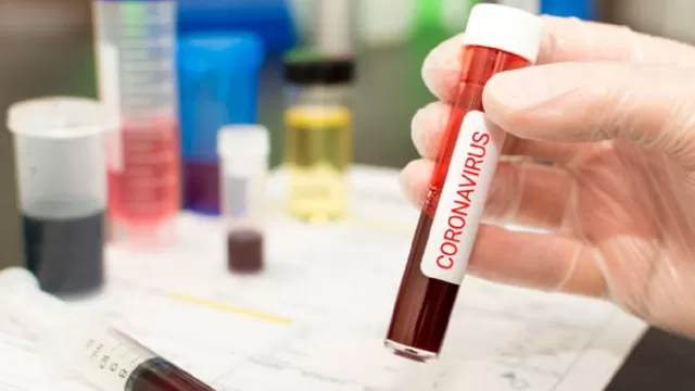 COVID-19: Variante del coronavirus detectada en Sudáfrica se propaga un 50% más rápido, pero no es más grave. Foto: 
