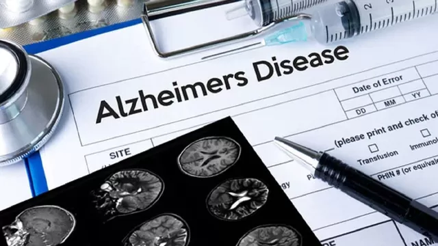 Estados Unidos aprueba el primer medicamento nuevo para el alzhéimer en casi 20 años