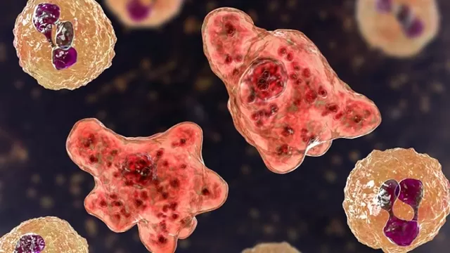 Estados Unidos: Florida confirma un nuevo caso de la ameba come cerebros. Foto: iStock referencial