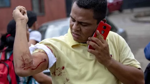 Entre los heridos se encuentra el periodista nicarag&uuml;ense Wiston Postome, quien recibi&oacute; un disparo en uno de sus brazos. (Foto: EFE)