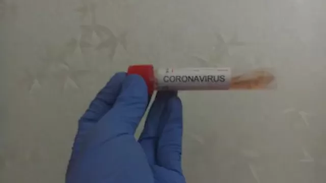 Coronavirus: Aumenta a 22 la cifra de casos de covid-19 en Nueva York. Foto: Shutterstock