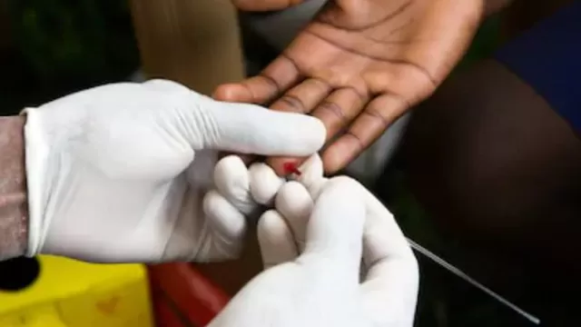Confirman segundo caso mundial de curación de un paciente con sida. Foto: Shutterstock
