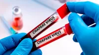 Chapare: ¿Qué se sabe del mortal virus detectado en Bolivia?