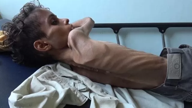 85.000 ni&ntilde;os han muerto de hambre desde que se intensificaron las hostilidades en la guerra del Yemen. (Foto: AFP)