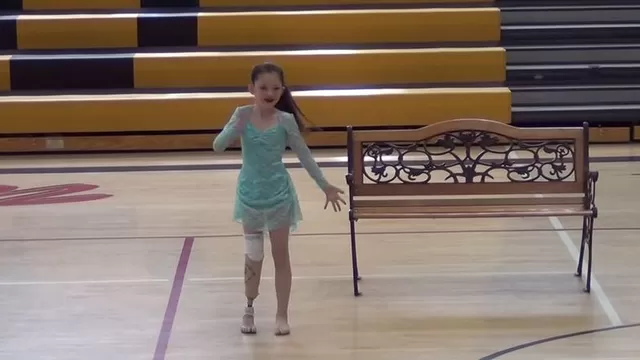 YouTube: emotivas imágenes muestran a una niña bailando tras amputación de pierna