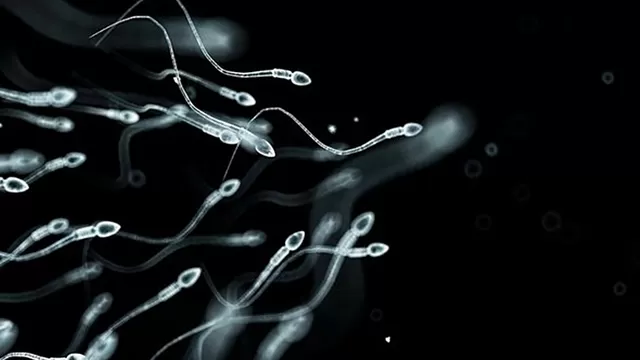 El espermatozoide es la célula reproductora masculina, móvil y flagelada. Imagen: Getty Images / Scientific American