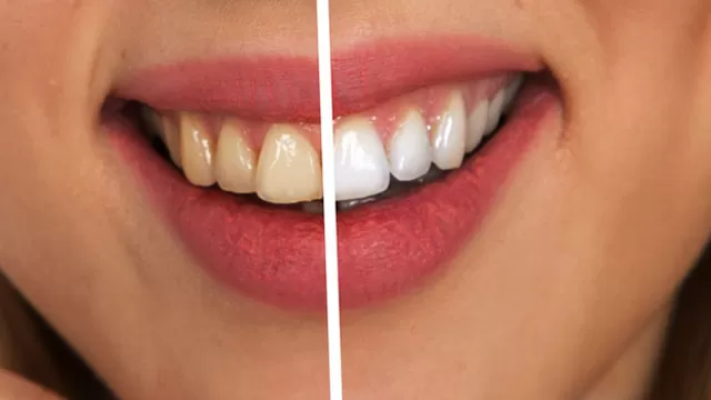 Alimentos y tips para tener los dientes más blancos