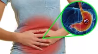 Cáncer de estómago: síntomas más notorios que no debes ignorar