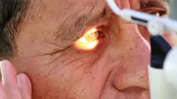 Carnosidad en los ojos: ¿puede volver después de una cirugía?