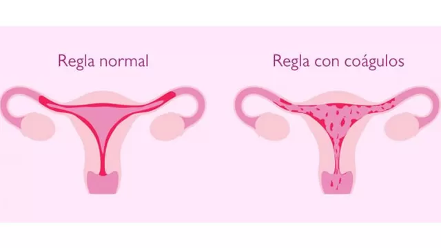 Descubre por qué salen coágulos de sangre en la menstruación