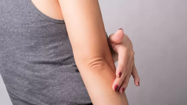 Conoce las causas por las que pueden aparecer manchas oscuras en codos y rodillas