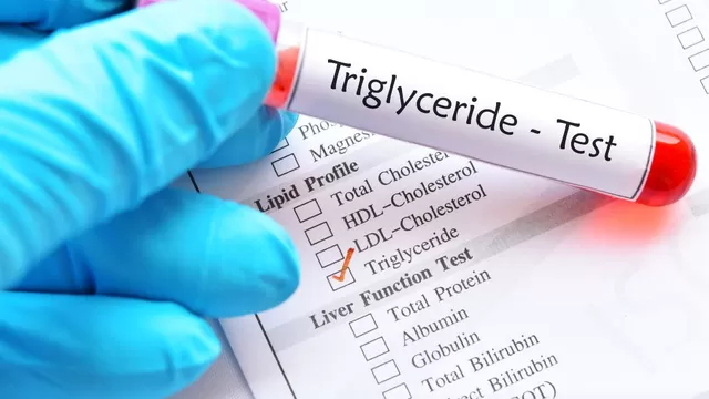 En los triglicéridos altos, existe grasa en la sangre en valores fuera de lo normal.