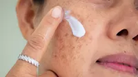 Qué productos sí pueden borrar las manchas del rostro