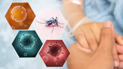 Síntomas del dengue que se pueden confundir con la COVID-19