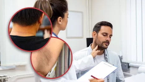 Manchas oscuras en el cuello: ¿Cómo quitarlas y qué enfermedad lo causa?