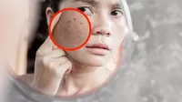 Cómo quitar las manchas de la cara