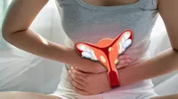 ¿Cómo saber si tienes miomas en el útero?