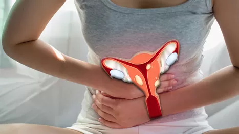 ¿Cómo saber si tienes miomas en el útero?