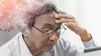 ¿Cómo se empieza a manifestar el Alzheimer?