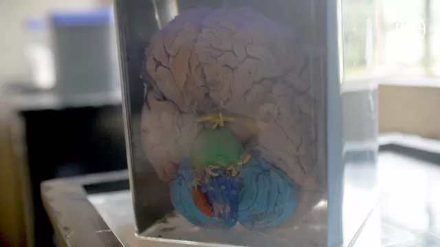 Base del cerebro, donde se muestra en rojo la amígdala cerebral. (Foto: Útil e Interesante)