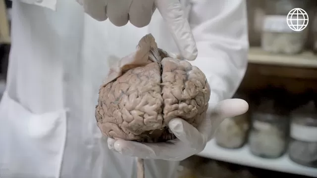 Lic. Prado señala la materia gris del cerebro. (Foto: Útil e Interesante)
