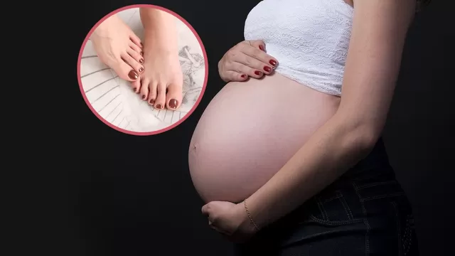 Lo que debes saber sobre algunos cambios físicos en el embarazo