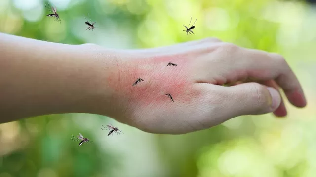 Lo que debes saber sobre la picadura de mosquitos.