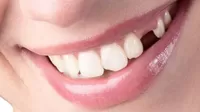 ¿Qué enfermedades pueden provocar que te quedes sin un diente?