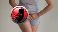 Flujo marrón en vez de menstruación: ¿cómo saber si es embarazo?