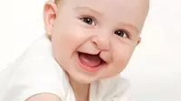 ¿Por qué los niños nacen con labio leporino?