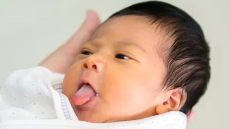 Bebés con lengua blanca: ¿cómo saber si es leche o algodoncillo?