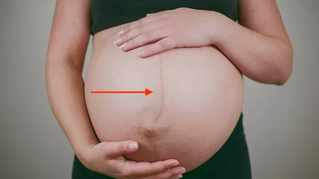 La línea marrón en la barriga de una mujer embarazada