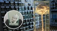 El museo que expone cerebros reales y las enfermedades más impactantes