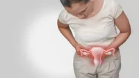 Síntomas del ovario poliquístico que deberías conocer