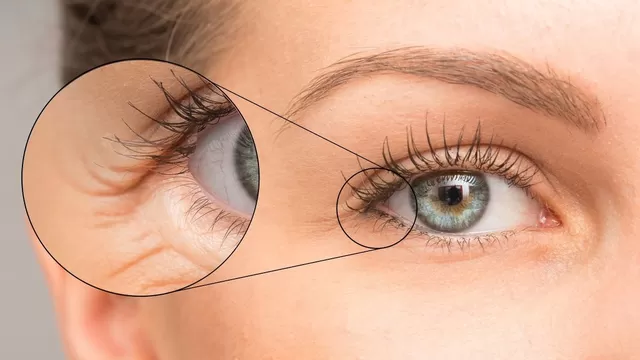 Lo que debes saber sobre las arrugas en el contorno de ojos.