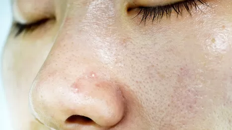 ¿Tienes textura en tu piel? 5 tips efectivos para un rostro lindo