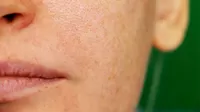 ¿Cómo reducir los poros abiertos en el rostro?