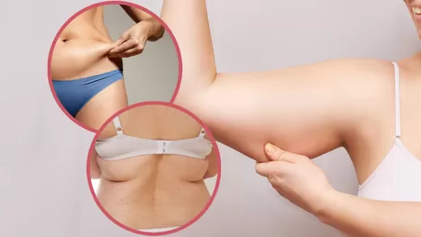 ¿Por qué acumulas grasa en la barriga, espalda o brazos?