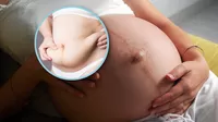 ¿Por qué se sale el ombligo durante el embarazo?