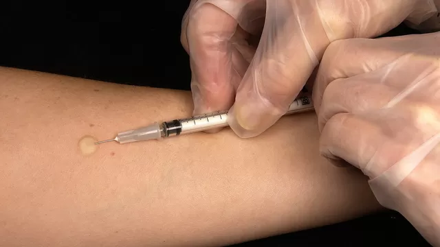 Aplicación de la vacuna BCG. (Foto: Animal Político)